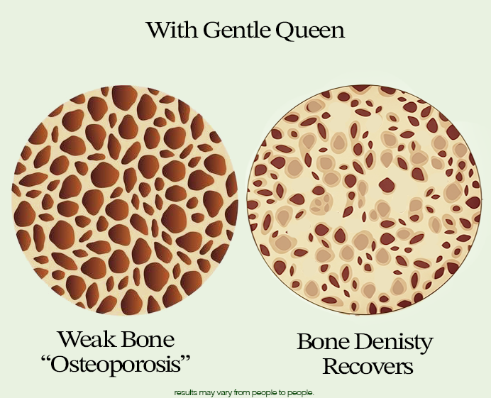 Gentle Queen™ - Essential Mobility Formula